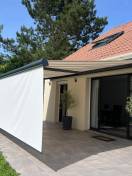 Store banne ON'X ouvert dans les Yvelines
