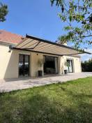 Store banne ON'X dans les Yvelines